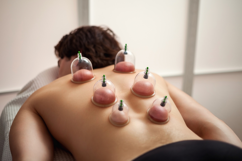 How Cupping Helps Release Deep Muscle Tightness You Didn’t Know You Had - chiropractor in metairie