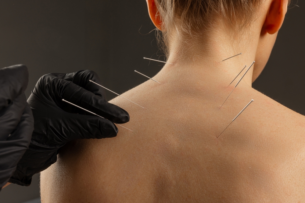 chiropractor in metairie - legacy chiropractor